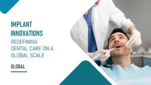 Dental Implantology Market: Redefining Dental Care on a Global Scale